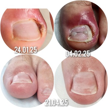 Подология фото 1