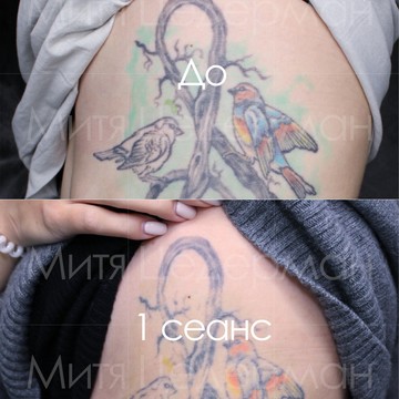 Клиника лазерного удаления татуировок KILL YOUR TATTOO фото 2