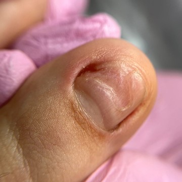 Центр сложного педикюра, восстановления ногтей и кожи ROSILAK фото 2