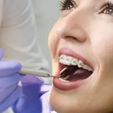 Стоматологическая клиника Fresh Dental clinics на Пятницком шоссе фото 1