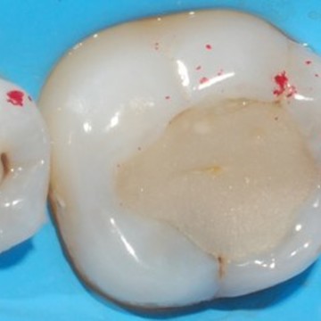 Дента-Кристалл, стоматология фото 2