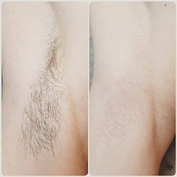 Студия депиляции Солнечный Город SADOWAXING фото 1