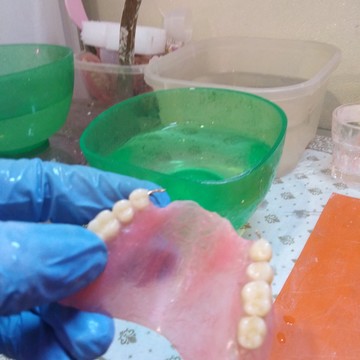 Ремонт съемных зубных протезов фото 3