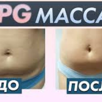 Студия Профессионального Массажа LPG фото 2