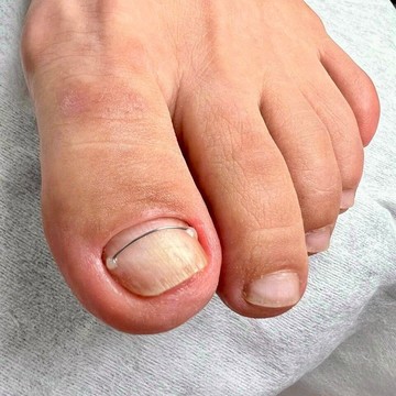 Студия подологии и педикюра 1-й Подологический фото 3