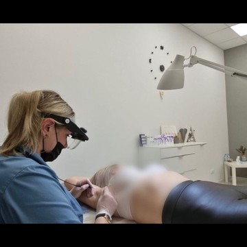 Студия электроэпиляции Epil Laser Time фото 3