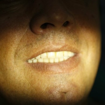 Круглосуточная стоматология на Тарутинской фото 3