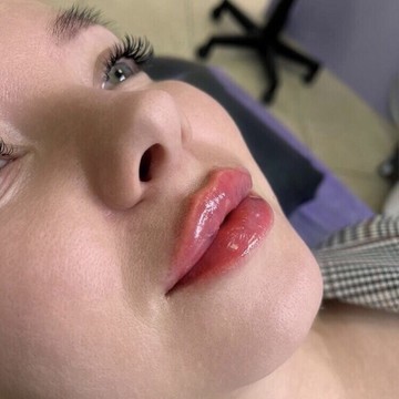 Студия коррекции фигуры и косметологии Новая я фото 3