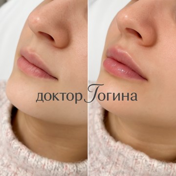 Косметологический кабинет доктора Гогиной фото 3