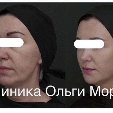 Клиника косметологии Ольги Мороз на Гоголевском бульваре фото 2