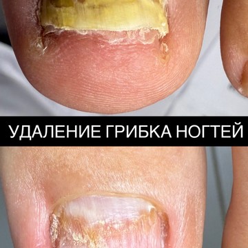 Подолог фото 3