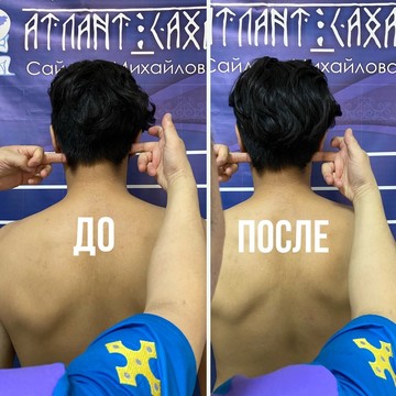 Центр здоровья позвоночника Атлант Саха фото 3