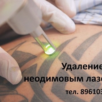 NoTattoo фото 1