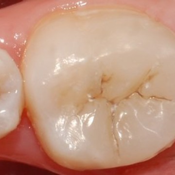 Дента-Кристалл, стоматология фото 1