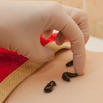 Купить пиявки Дзержинский фото 1