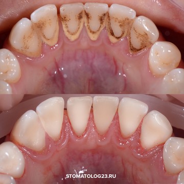 Семейная стоматология Улыбка фото 3