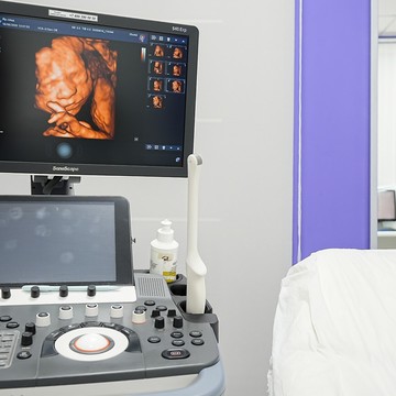 Кабинет УЗИ-диагностики ЯрМед фото 3