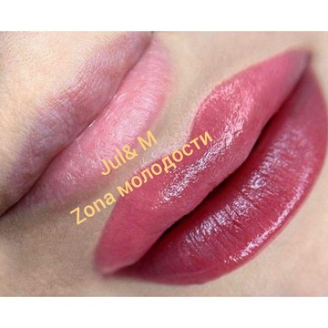 Центр косметологии Zona молодости фото 2