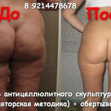 Академия элитного массажа, косметологии и гипноза slim-girls.ru фото 2