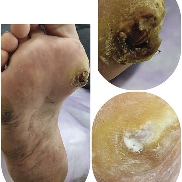 Подология фото 2