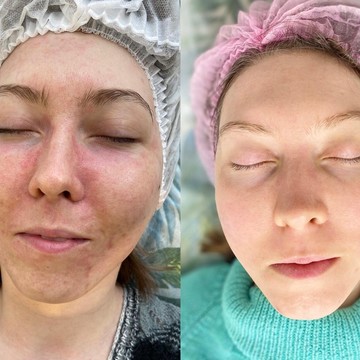Студия косметологии No Filters Beauty фото 1