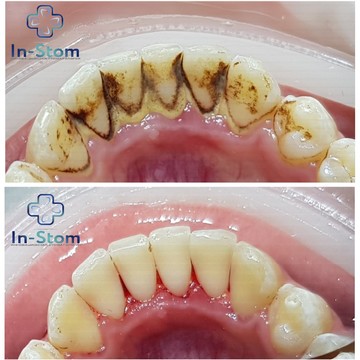 Инновационная стоматология фото 2