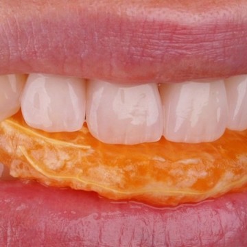 Стоматология Premium Smile в Жулебино фото 3