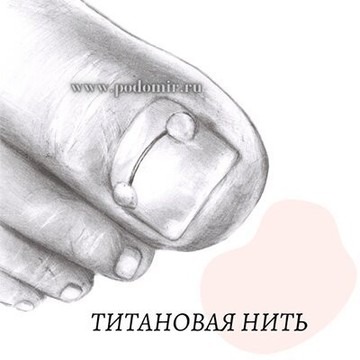 Ногтевая студия Мир Подологии фото 3