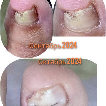 Подология фото 3