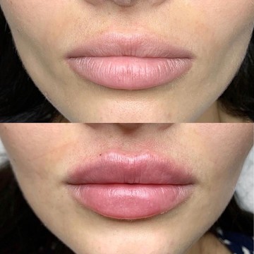 Клиника эстетической медицины Quantum Clinic на улице Авиаконструктора Сухого фото 2