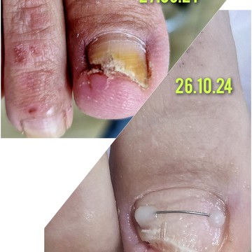 Центр не медицинской Подологии Ольги Марковой фото 3