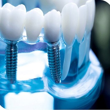 Стоматологическая клиника Зубы за день фото 1