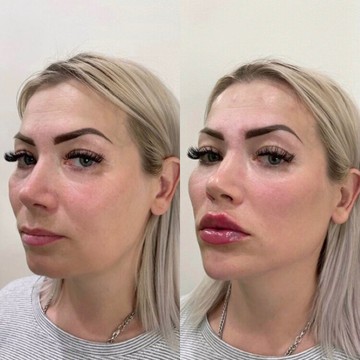 Студия коррекции фигуры и косметологии Новая я фото 2