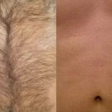 Депиляция в СПб недорого фото 3