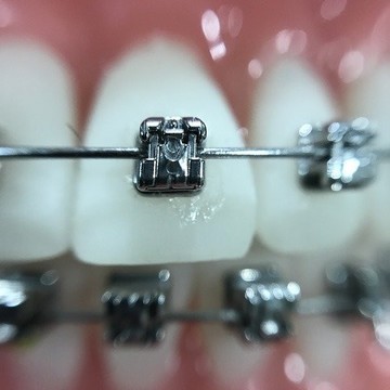 Стоматологический центр имплантации и ортодонтии Дэнталюкс фото 2