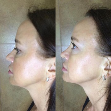 Кабинет косметологии Doc.Facelift фото 1