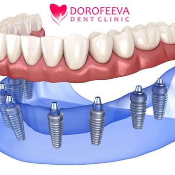 Стоматологическая клиника Implant DorofeevaDent фото 3