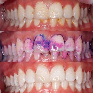 Клиника семейной профилактической стоматологии Белая Радуга на Бауманской фото 3