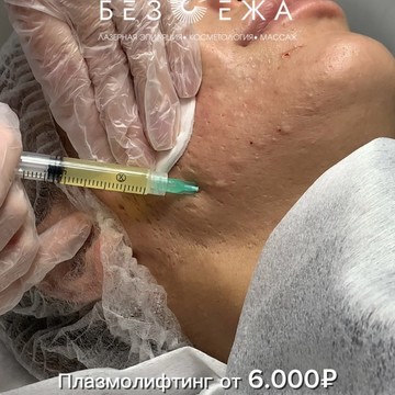 Без Ежа центр лазерной эпиляции/ косметологии фото 3