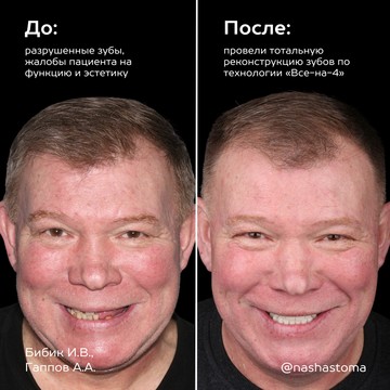 Наша стоматология на Крестьянском переулке фото 3