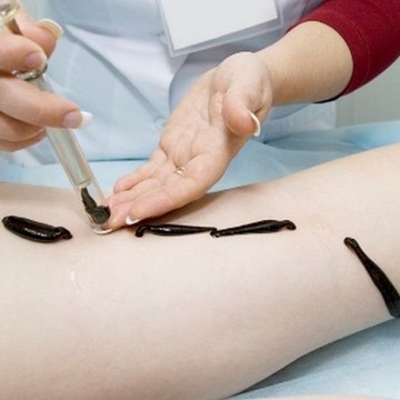 Купить пиявки метро Новокосино фото 1