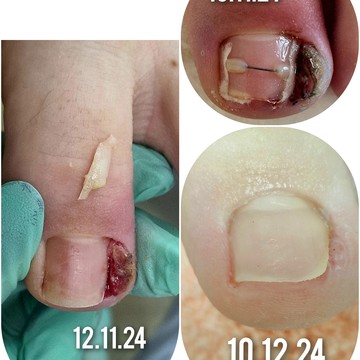 Центр не медицинской Подологии Ольги Марковой фото 2