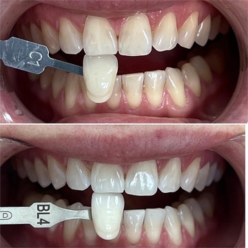 Salident фото 2