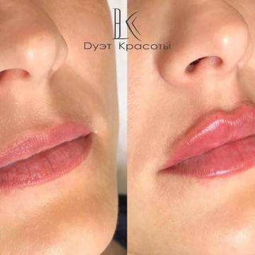 Студия косметологии Дуэт красоты фото 2