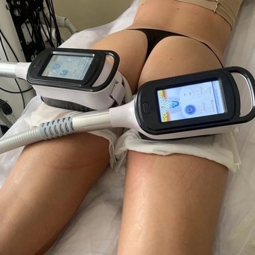 Студия криолиполиза фото 2