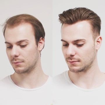 Система волос Романа Климова фото 1