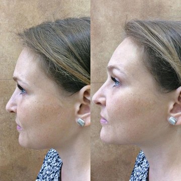 Кабинет косметологии Doc.Facelift фото 3